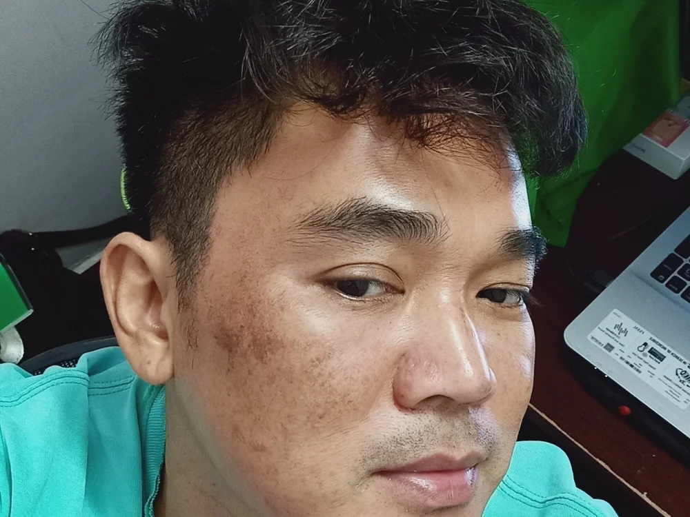 NguyenTrungHieu81 — Stripchat՝ լուսանկարներ և պրոֆիլ